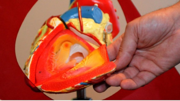 Heart model