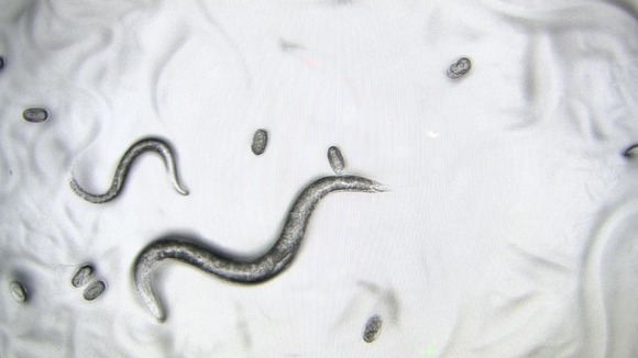 Worms at UCL