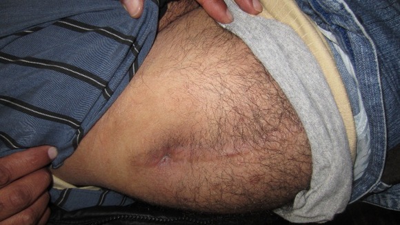 Injured protester showing wound