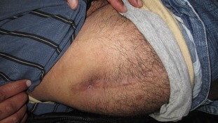 Injured protester showing wound