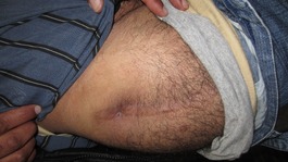 Injured protester showing wound