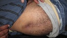 Injured protester showing wound