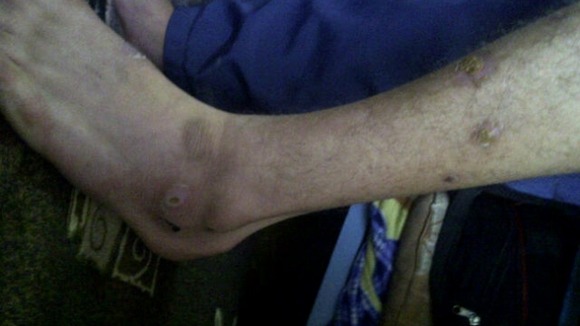Injured protester showing wound