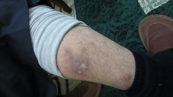Injured protester showing wound