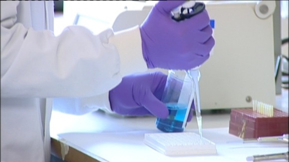 Cystic fibrosis trials to begin