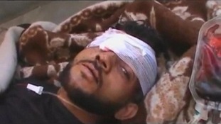 A young man wounded from shelling in Tremseh in Syria.
