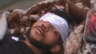A young man wounded from shelling in Tremseh in Syria.