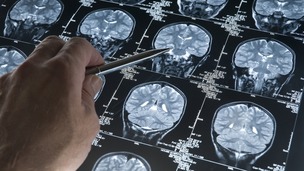 Individual care 'poorly coordinated' and quality of service 'depends on where you live'