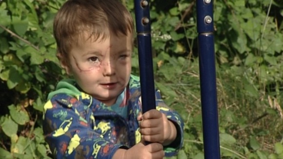 2-year-old Kieran