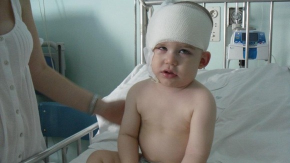Finn after the op
