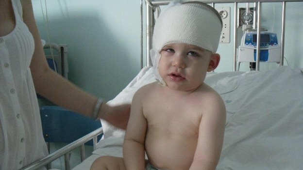 Finn after the op