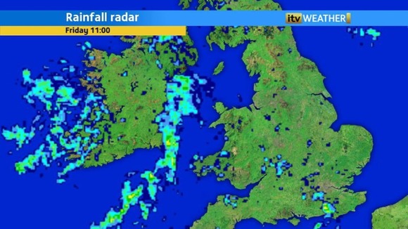 Radar