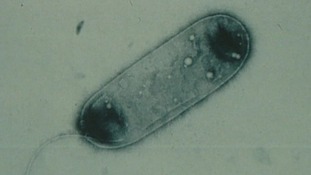 The legionella bacteria views under a microscope