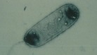 The legionella bacteria views under a microscope