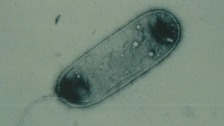 The legionella bacteria views under a microscope