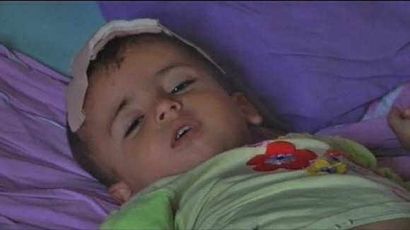 Injured child in Azaz.