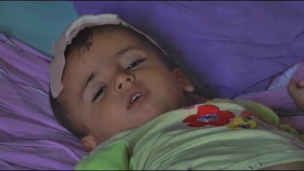 Injured child in Azaz.