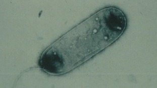 Legionnaires'