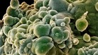 Prostate cancer cells