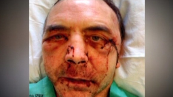Headteacher Kieran Heakin who has been beaten twice is calling for parenting classes to help tackle classroom violence.