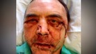Headteacher Kieran Heakin who has been beaten twice is calling for parenting classes to help tackle classroom violence.