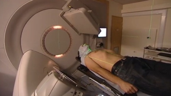 3D radiotherapy