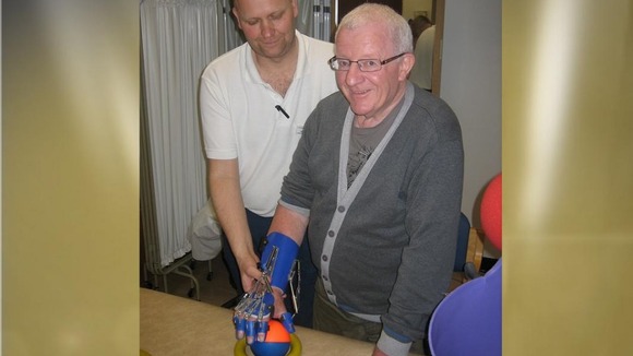 Bionic arm