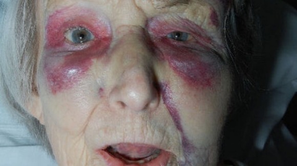 The victim of the attack, who has been named only as Lynne, is 91 years old.