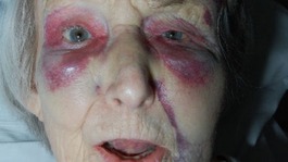 The victim of the attack, who has been named only as Lynne, is 91 years old.