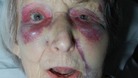 The victim of the attack, who has been named only as Lynne, is 91 years old.