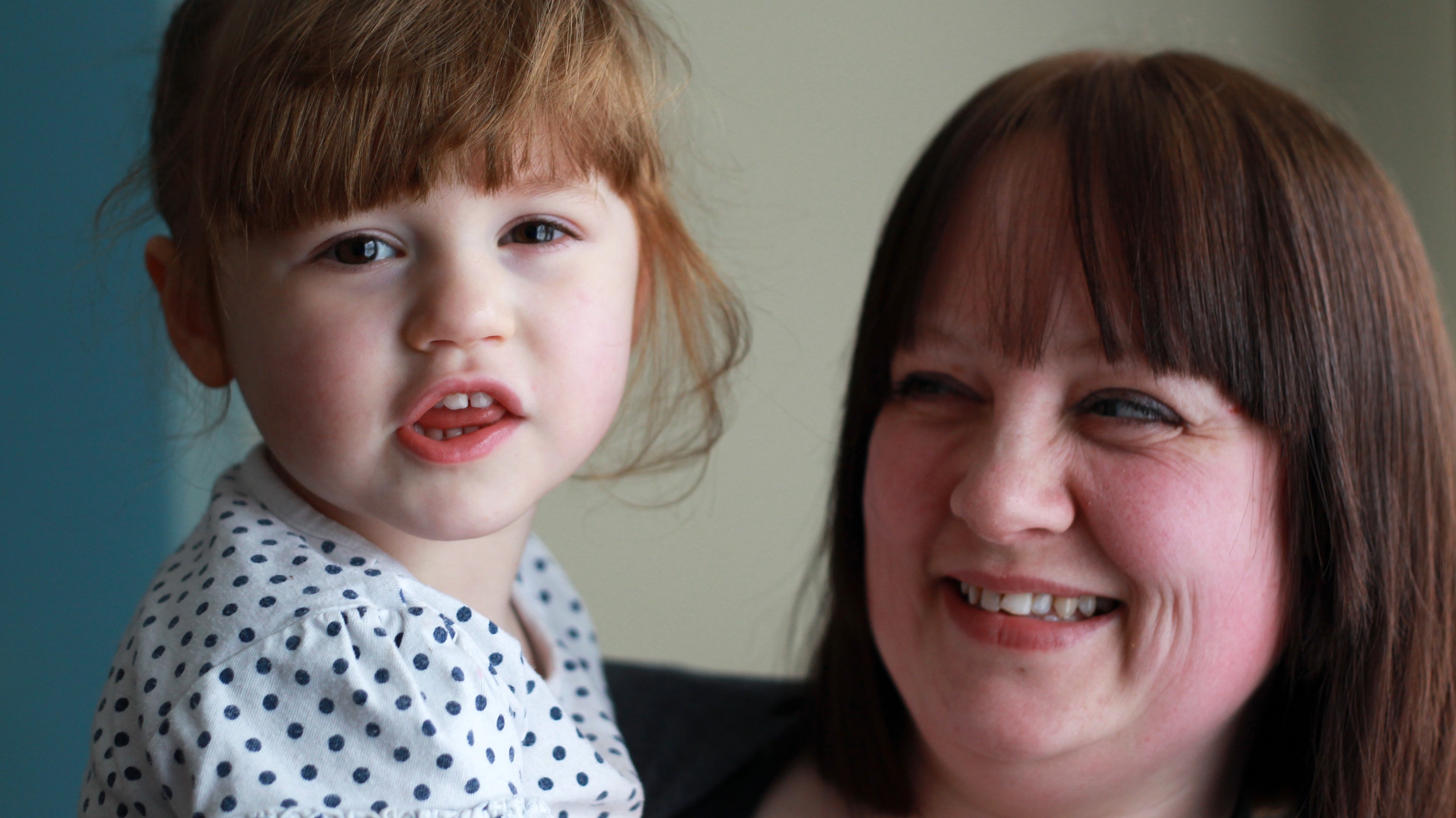 Toddler 'lucky to be alive' after acid from battery she swallowed burnt