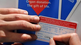 Organ donation: public attitudes need to change