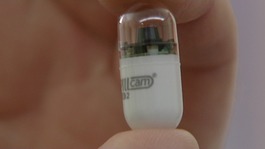 The pill cam broadcasts pictures from inside the prof's stomach