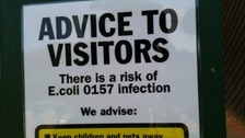 Children infected with e.coli