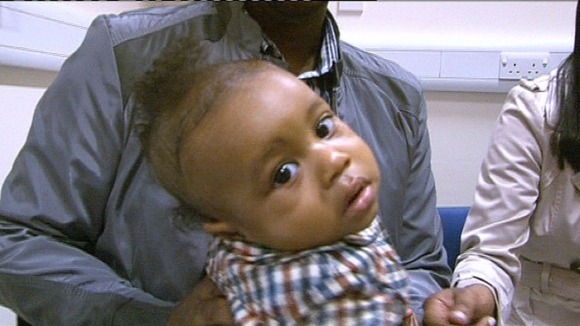 Romero Neville was diagnosed with retinoblastoma