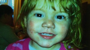 2 year old Georgia Keeling died from meningitis