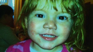 2 year old Georgia Keeling died from meningitis